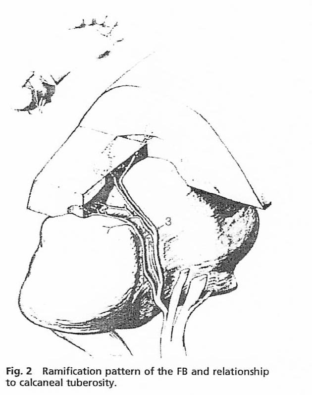 Ramification pattern of the first branch of the lateral plantar nerve.