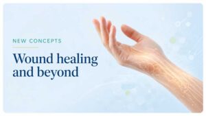 Illustration of a healing hand and forearm for New Concepts in Wound Healing and Beyond